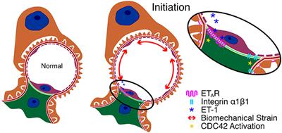 Molecular and Cellular Mechanisms Underlying the Initiation and Progression of Alport Glomerular Pathology